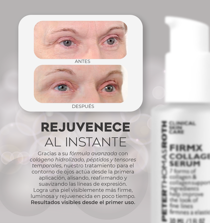 Tensor facial peter thomas